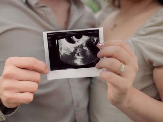 ultrasound